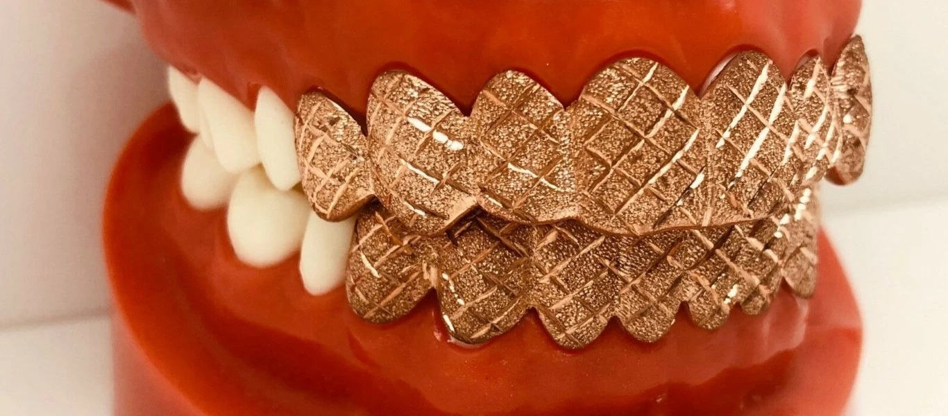 H νέα μόδα που ήρθε από το παρελθόν για να μείνει - Τα οδοντικά κοσμήματα που κάνουν θραύση (φώτο)